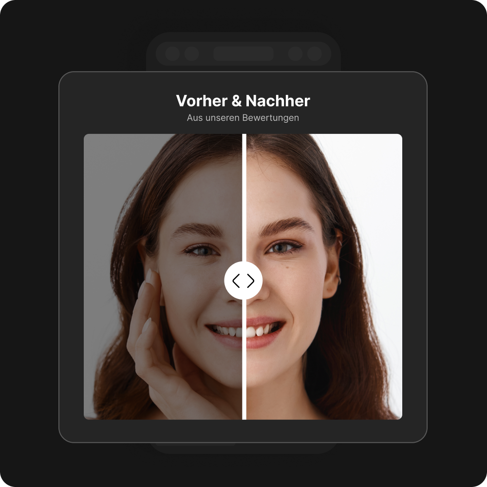 Vorher vs. Nachher Slider